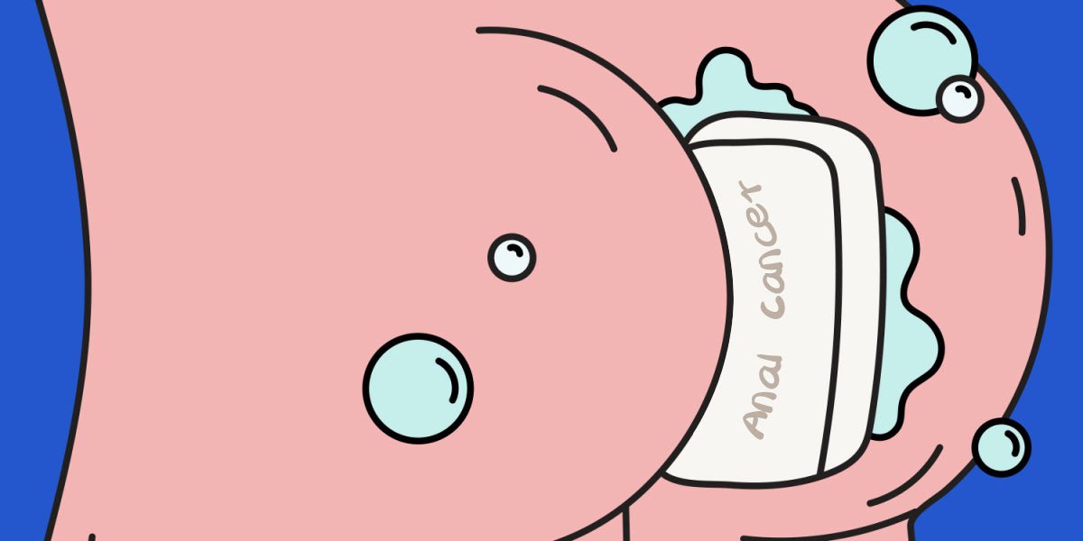 Anal Cancer - The Risks and How to Avoid it - Sohimi